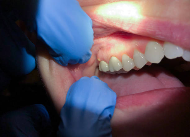 Best Urgent Tooth Repair  in Jasper, TN